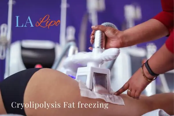 women getting fat freezing Wood Green