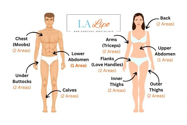 LA LIPO Cryolipolysis Areas Wood Green