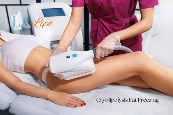 Woman receiving coolsculpting Wood Green treatment on her thighs