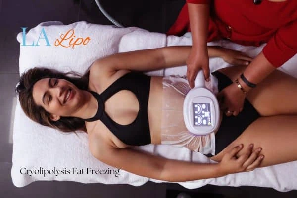 woman getting cryolipolysis Wood Green