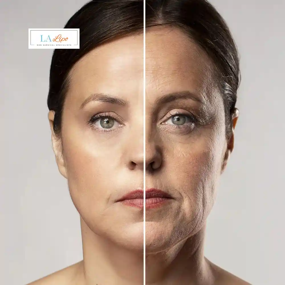 How Can You Tell If Non-Surgical Skin Tightening Is Right for You Wood Green?