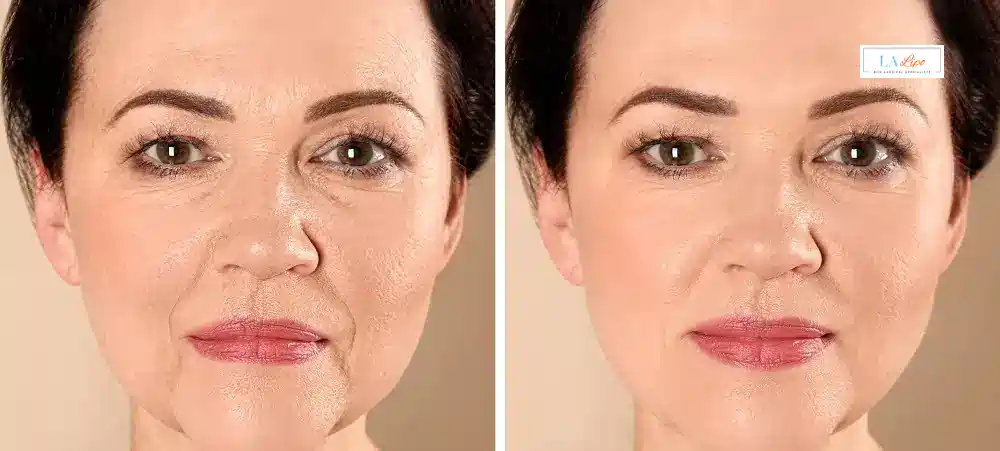 How Long Does It Take to See Results and How Long Do They Last Wood Green?