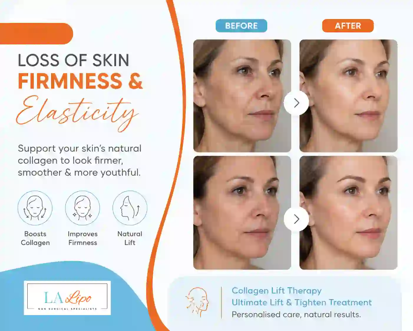 Sign #7: Loss of Skin Firmness and Elasticity Wood Green